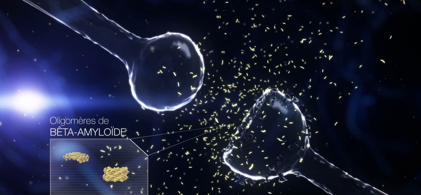 Le rôle de la protéine neuroligin-1 dans la maladie d’Alzheimer Le rôle de la protéine neuroligin-1 dans la maladie d’Alzheimer