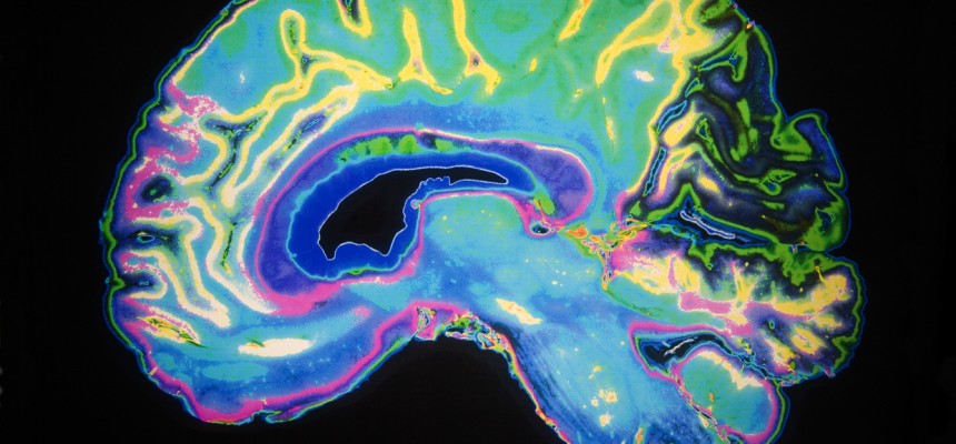Maladie d’Alzheimer : des facteurs protecteurs ? Maladie d’Alzheimer : des facteurs protecteurs ?